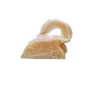 Flexigraft®  Meniscus- 半月板軟骨(膝蓋)